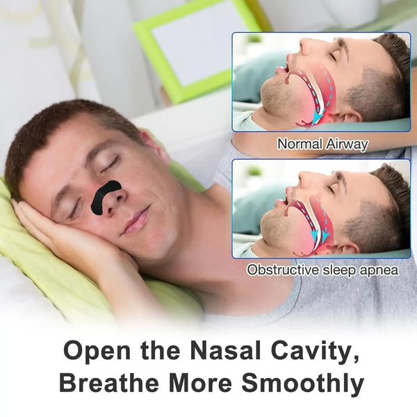 Anti-Snoring-Nose-Strips-for-Breathing-Correction-Physical-Expansion-Breathable-Nasal-Patch-Better-Sleep-Anti-Snoring.png